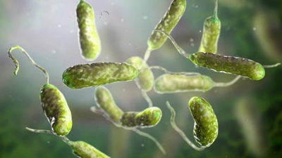No cholera cases in the Western Cape