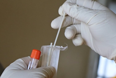 SA logs 1 332 new Covid-19 infections, with 88 deaths