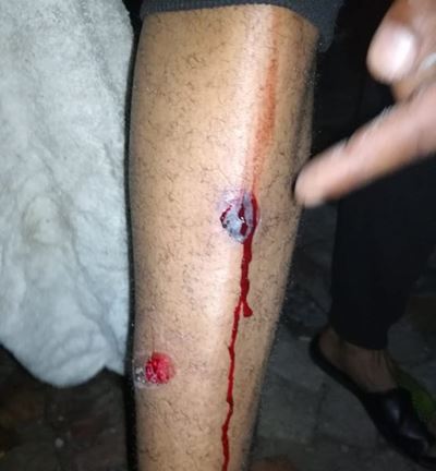 Protests flare up in Smutsville, Sedgefield