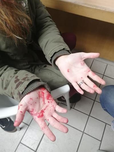 Padwoede op twee vroue lei glo na aanranding