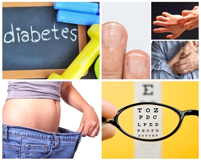 Some symptoms of complicated, sometimes difficult to diagnose, diabetes