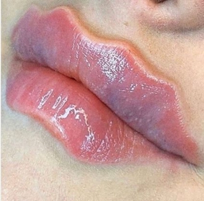 Wavy octopus lips are the new insanely hilarious lip trend