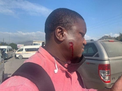 Journo details moment rubber bullet hit his face during taxi uproar