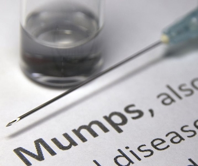 NICD confirms mumps outbreak in South Africa