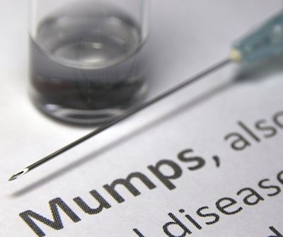 NICD confirms mumps outbreak in South Africa