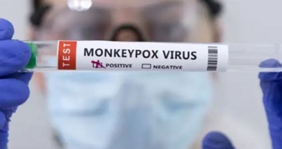 WHO calls emergency meeting as monkeypox cases rise 