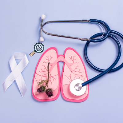 TB civil society supports SA’s ambitious TB targets  