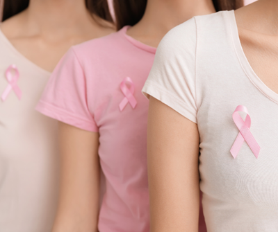 Breast cancer on the rise in younger South African women