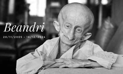 Progeria warrior Beandri Booysen passes away at 19