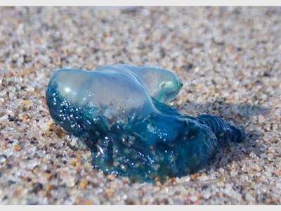 Dealing with blue bottle stings