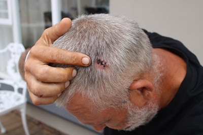 Verdagte in Groot Brak-mesaaval bly in aanhouding
