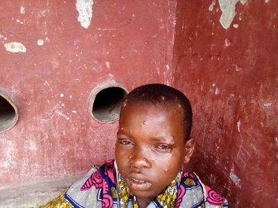 Preventative measures to stop the transmission of monkeypox to animals