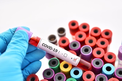 Covid update: KZN records highest number of new COVID-19 infections