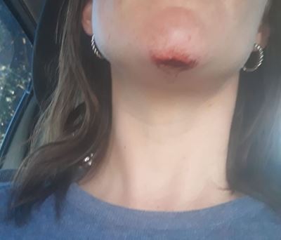 Why to wear a helmet while skateboarding