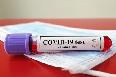 Green light for CapeBio to manufacture COVID-19 rapid test kits