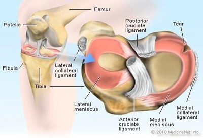 Meniscus injuries