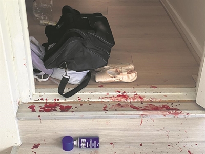 Businessman savagely attacked