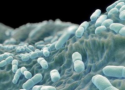 Western Cape: 115 cases of listeriosis confirmed