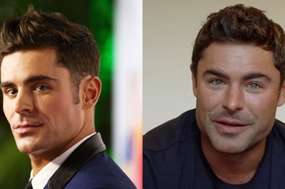 ‘Jaw gate’– Zac Efron denies he’s done plastic surgery