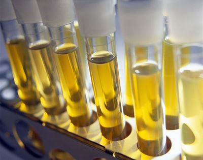 South Africa makes world’s first human urine brick