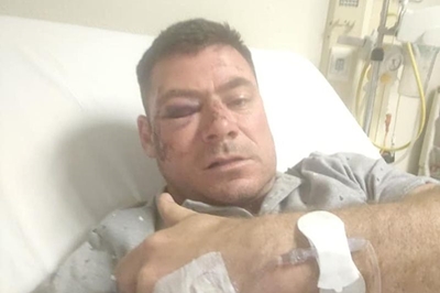 Former Springbok player beaten up after Boks-All Blacks Test in Mbombela
