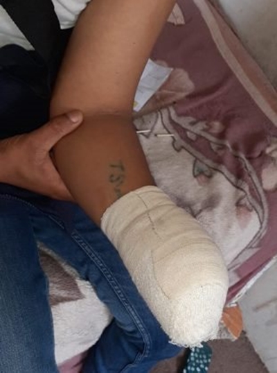 Worker loses hand in freak accident