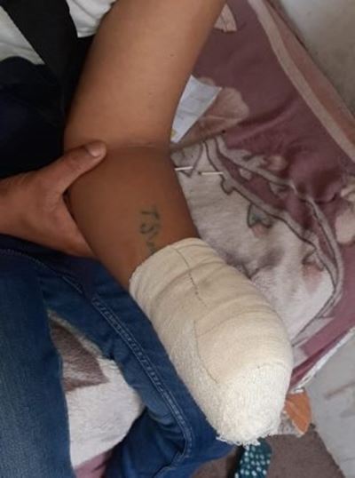 Worker loses hand in freak accident