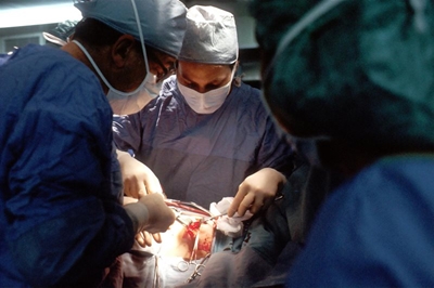 Colon cancer: Symptoms, causes and treatment