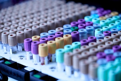 Labs soldier on in the face of cyberattack