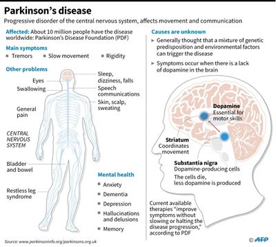 Japan team transplants stem cells into brain to treat Parkinson's