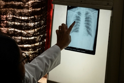 7 of top 10 killers pre-Covid were non-communicable diseases: WHO