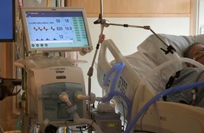 Covid-19 death after liver disease may reveal difference in care: study