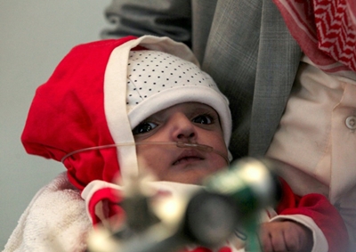 Yemen children starve as food and fuel prices soar