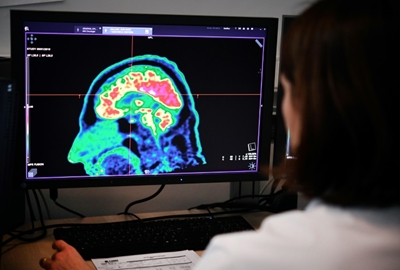 AI matches human brain cancer diagnosis: study
