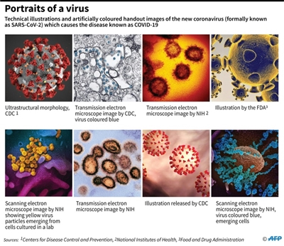 World failed to learn SARS lessons for coronavirus fight