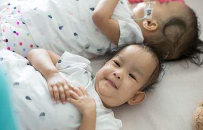 Bum shuffles as ex-conjoined twins try out independence