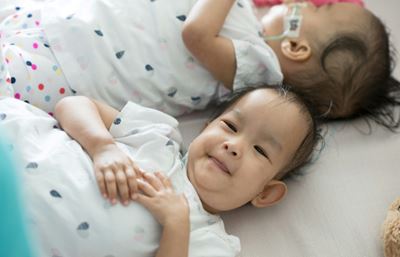 Bum shuffles as ex-conjoined twins try out independence