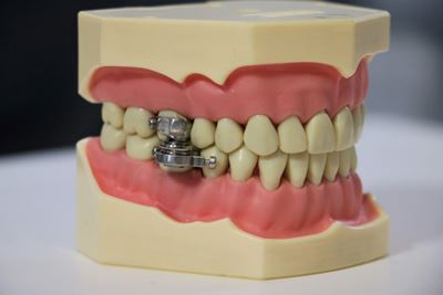 Researchers trial magnetic 'lockjaw' against obesity