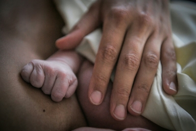 11 more cases of babies born with deformed arms in France