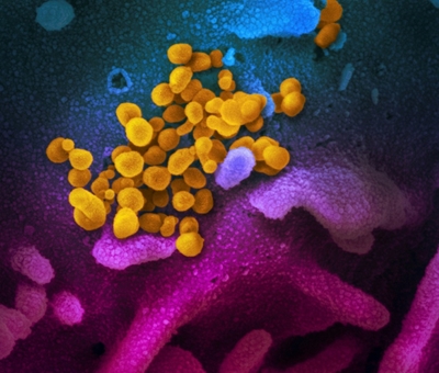 Current dominant strain of COVID-19 more infectious than original: study