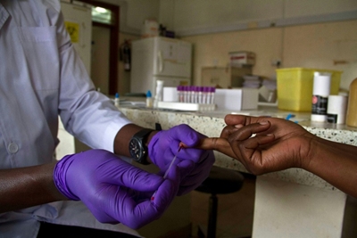 AIDS deaths down a third since 2010: UN 
