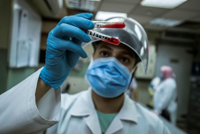 Egypt tries plasma treatment to fight pandemic