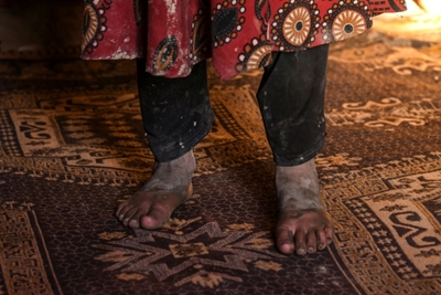 Hunger forces Afghans to sell young daughters into marriage