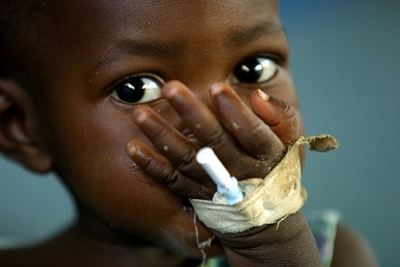 Severe exposure to pathogens can cause childhood stunting: study