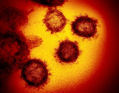 US man, 30, dies from virus after attending 'COVID party'