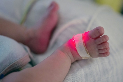 France launches nationwide probe into baby arm birth defects