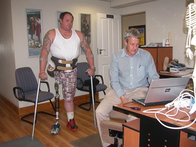 Update: Local gets computerised prosthesis