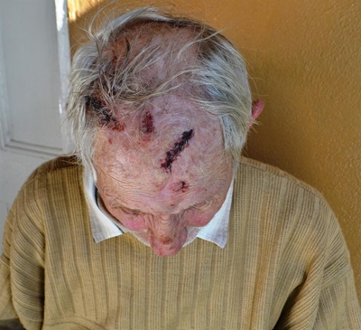 Bejaarde wreed aangeval: 2 in hof
