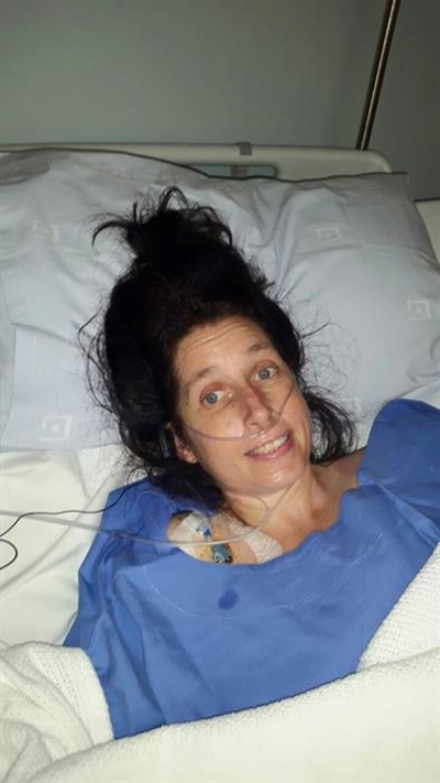 Knysna woman on the mend after dog attack