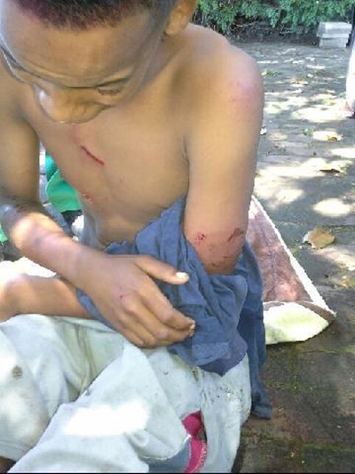 Settlement after dog attacks boy